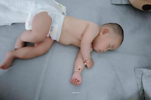 大竹宝宝头上长痱子